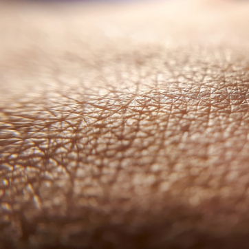 How Diabetes Can Affect Your Skin