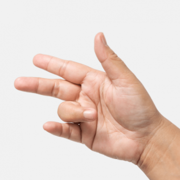 Symptoms and Treatment of Trigger Finger